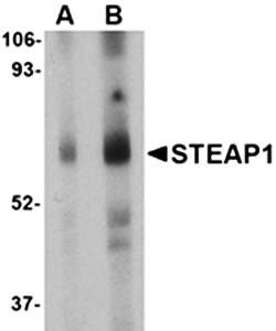 STEAP1 Antibody