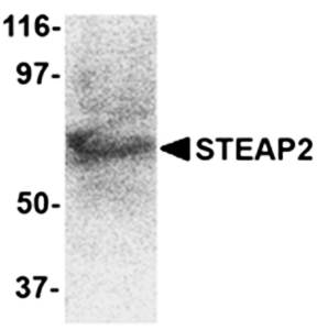 STEAP2 Antibody