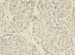 STEAP3 antibody