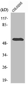 STEAP3 antibody