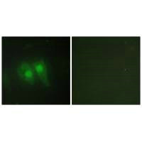 STEAP3 Antibody