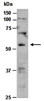 STEAP3 (N) Antibody, Rabbit Polyclonal