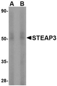 STEAP3 Antibody
