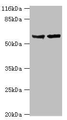 Steroid 17-alpha-hydroxylase/17, 20 lyase antibody