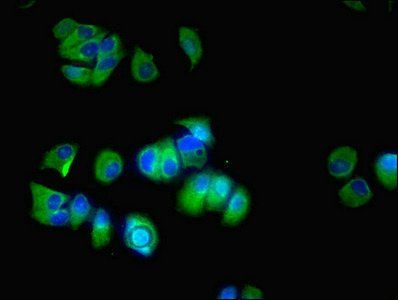 Steroid 17-alpha-hydroxylase/17, 20 lyase antibody