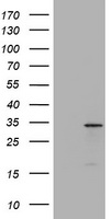 Sterol carrier protein 2 (SCP2) antibody