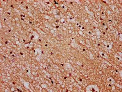 STH Antibody