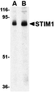 STIM1 Antibody