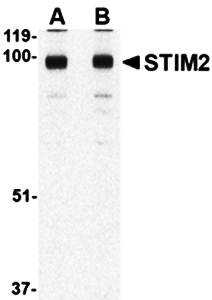 STIM2 Antibody