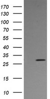 STING (TMEM173) antibody