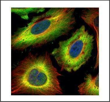 stress induced phosphoprotein 1 Antibody