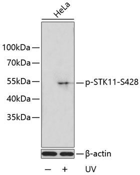 STK11 (Phospho-S428) antibody