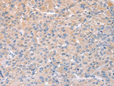 STK16 Antibody