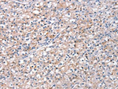 STK16 Antibody