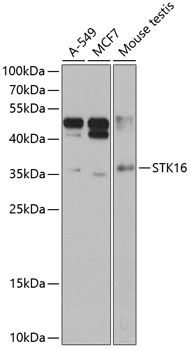 STK16 antibody