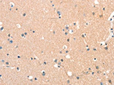 STK17A Antibody