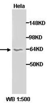 STK17A Rabbit Polyclonal Antibody