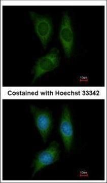 STK25 antibody [N1C1]
