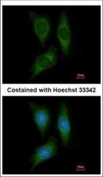 STK25 antibody