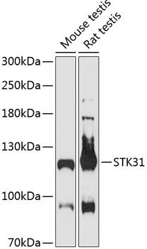 STK31 antibody