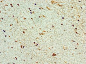 STK32A Antibody