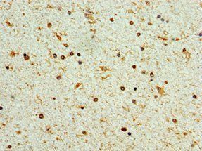 STK32A Antibody