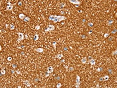 STK32A antibody