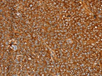 STK32A Antibody