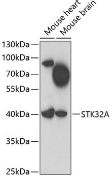 STK32A antibody