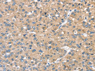 STK32C Antibody