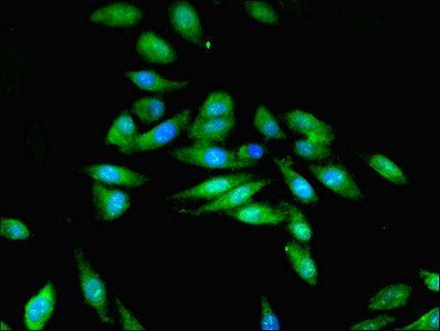STK33 Antibody