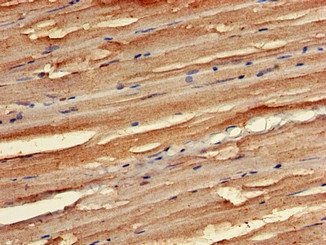 STK35 Antibody