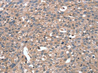 STK36 Antibody