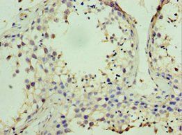 STK38 Antibody