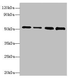 STK38L antibody