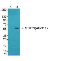 STK39 (Ab-311) antibody