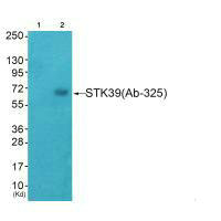 STK39 (Ab-325) Antibody