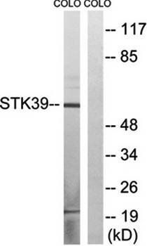 STK39 antibody