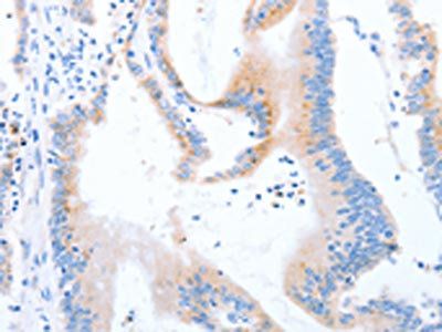 STK4 Antibody