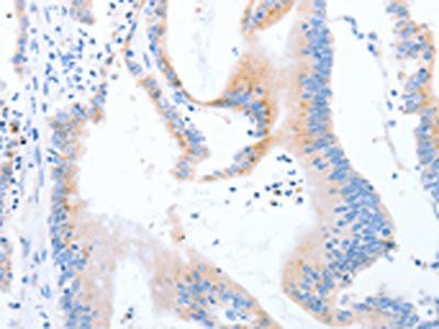 STK4 antibody