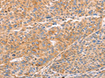 STK4 Antibody