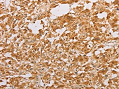 STK40 Antibody