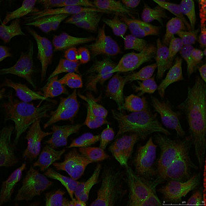 STMN1 (Ab-25) Antibody