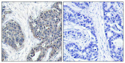 STMN1 (Ab-38) Antibody