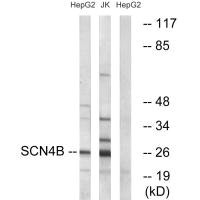 STMN1 Antibody