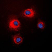 STMN1 (phospho-S16) antibody