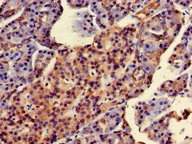 STMN2 Antibody