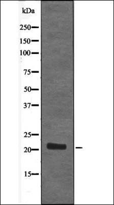 STMN2 (Phospho-Ser73) antibody