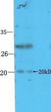 STMN3 Rabbit Polyclonal Antibody