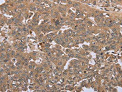 STMN2/STMN3/STMN4 Antibody